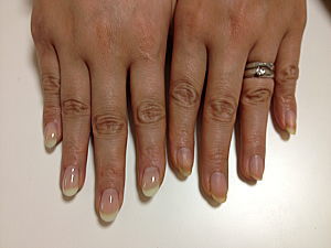 �l�C���@�⋭�̃C���[�W