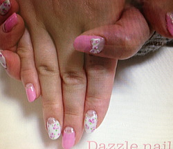 �~�N�X�`���A���{���̎{�p��@2