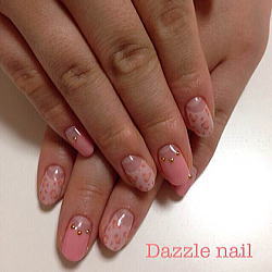 女の子レオパード