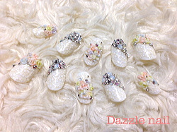 ブライダルチップ